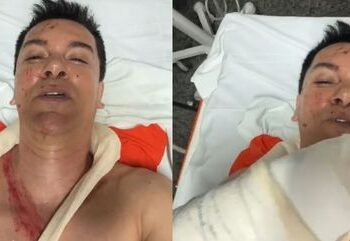 Cantor Regis Danese teve órgão perfurado em acidente e passa por cirurgia de emergência