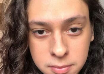 Victor Meyniel sofre homofobia e é covardemente agredido