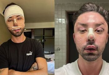 Rico Melquiades se viciou em remédio após onda de críticas: ‘Precisava me dopar para dormir’